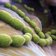 Streptococcus thermophilus