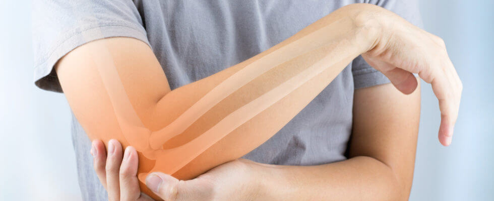 Arthrose Akute Traumata - Naturoscience